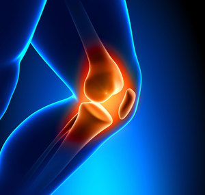 Остеохондроз коленного сустава: лечение