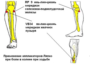 Причины заболевания коленого сустава