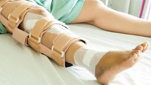Метод лечения при перелома коленной чашечки
