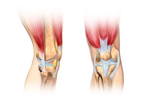 Растяжение связок колена: лечение