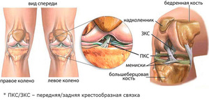 Боль в колене 