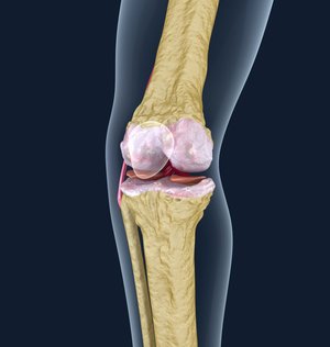Признаки остеопороза коленного сустава