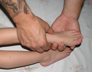Как делать массаж при варусной деформации у ребенка