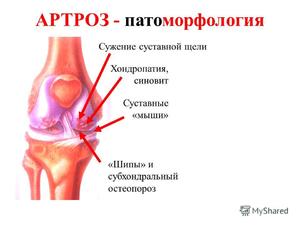 Как проводится операция на коленном суставе