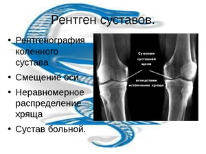 Как проводится процедура рентгена